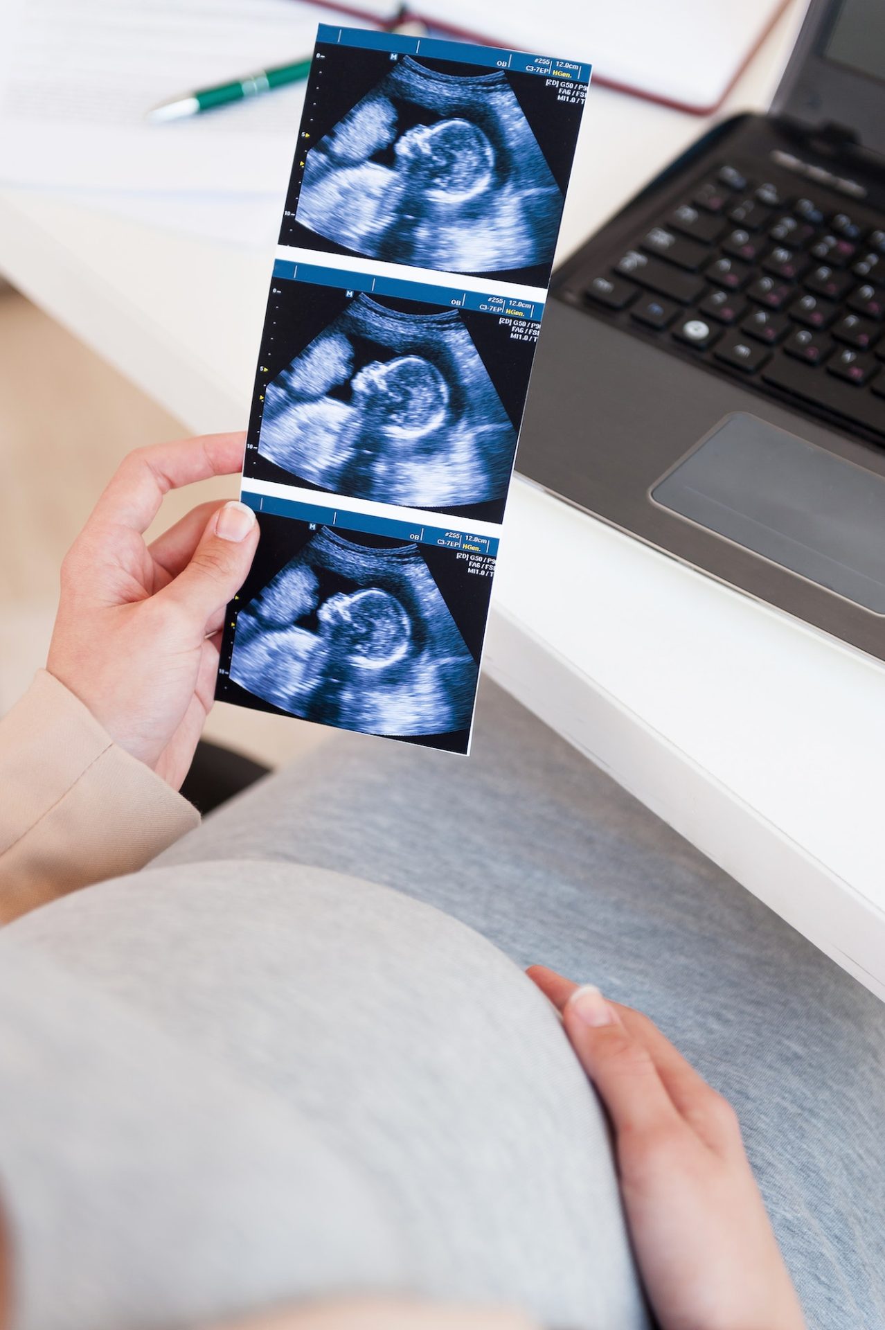 Woman with sonogram picture.