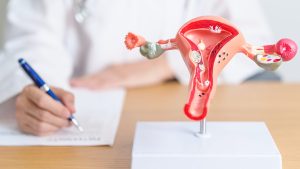 endometriozis-nedir-ve-nasil-tedavi-edilir-bilmeniz-gerekenler